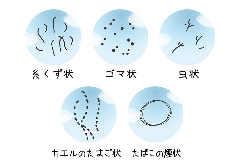 ほこりや糸くず、黒い点が見える？飛蚊症の見え方