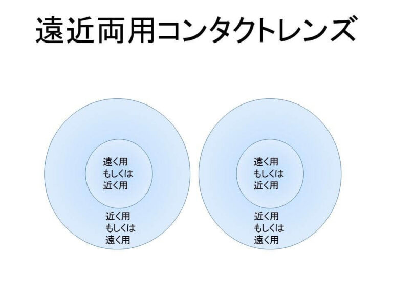 コンタクトレンズ老眼対策－３遠近両用コンタクト