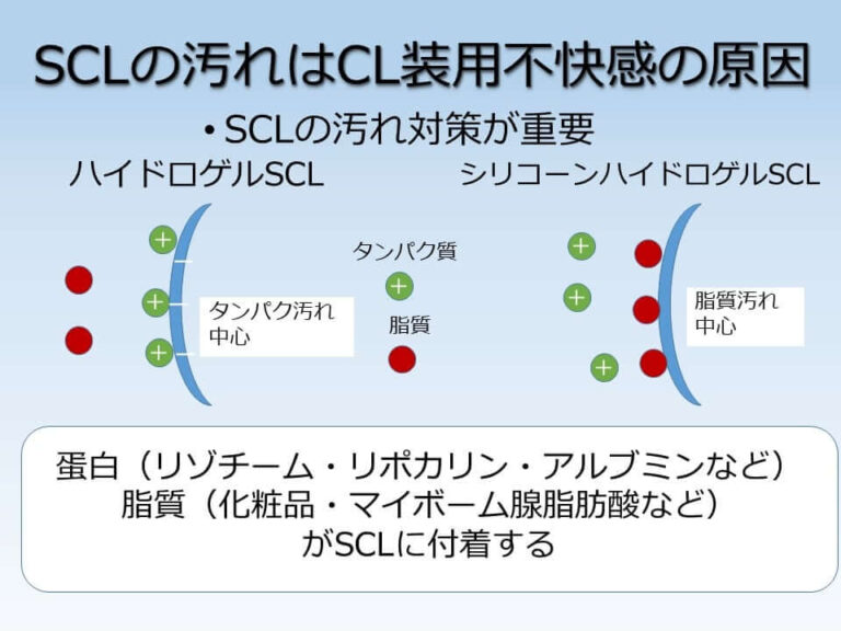 レンズの汚れ