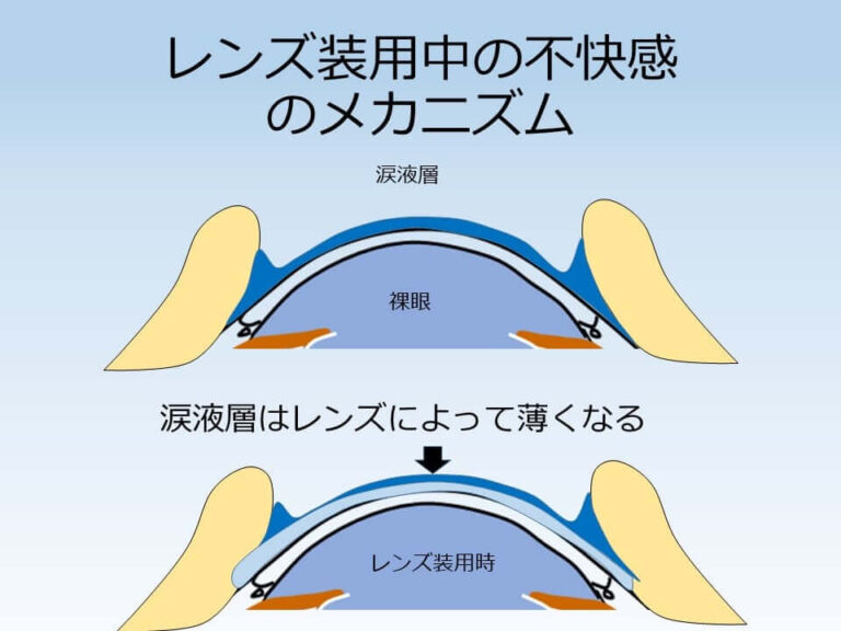 コンタクトレンズのデザイン（厚み）